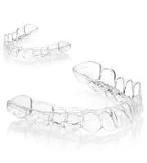 Clear Aligner